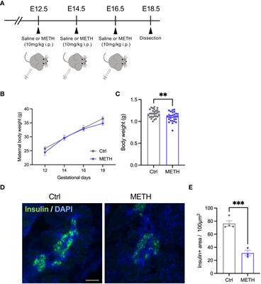 Prenatal methamphetamine exposure causes dysfunction in glucose metabolism and low birthweight